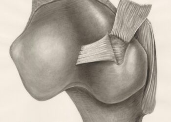 The Brace Graveyard: Why Your Knee Brace Isn’t Working and How to Finally Find the Right One