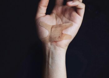 An Expert Analysis of Acute Pain Duration: From Initial Injury to Resolution or Chronicity