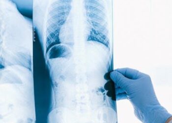 A Comprehensive Clinical Report on the Safe and Efficacious Use of Ibuprofen
